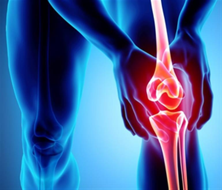 Early detection of 'osteoarthritis' may allow therapy that improves joint health: Researchers