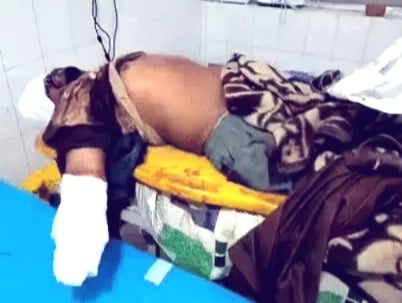 Man’s hand chopped off in brutal house attack in Ludhiana