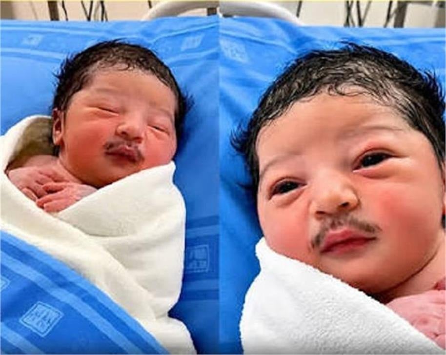 Newborn Baby’s Moustache-Like Facial Hair Leaves People Stunned! Viral Photo Sparks Buzz, Users Say He Looks Born With a Lifetime of Responsibilities